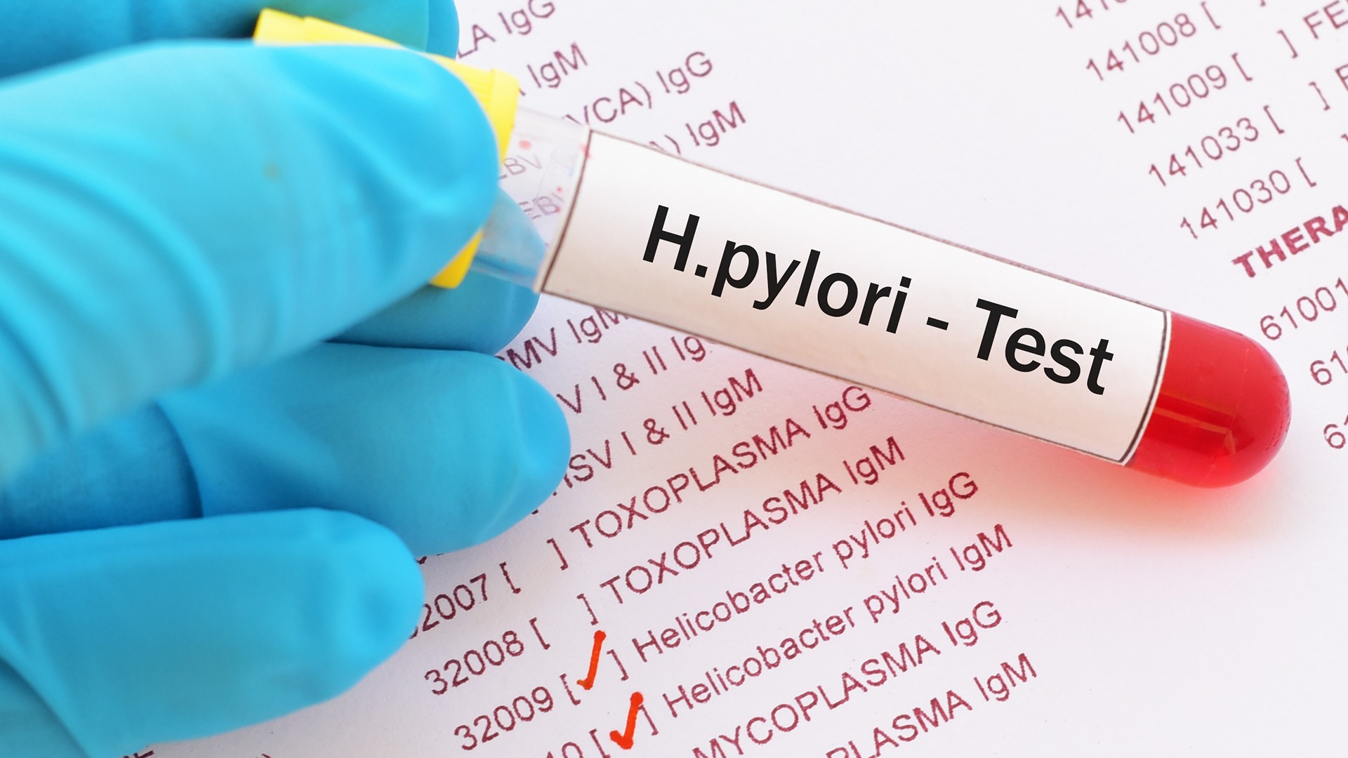 test h.pylori