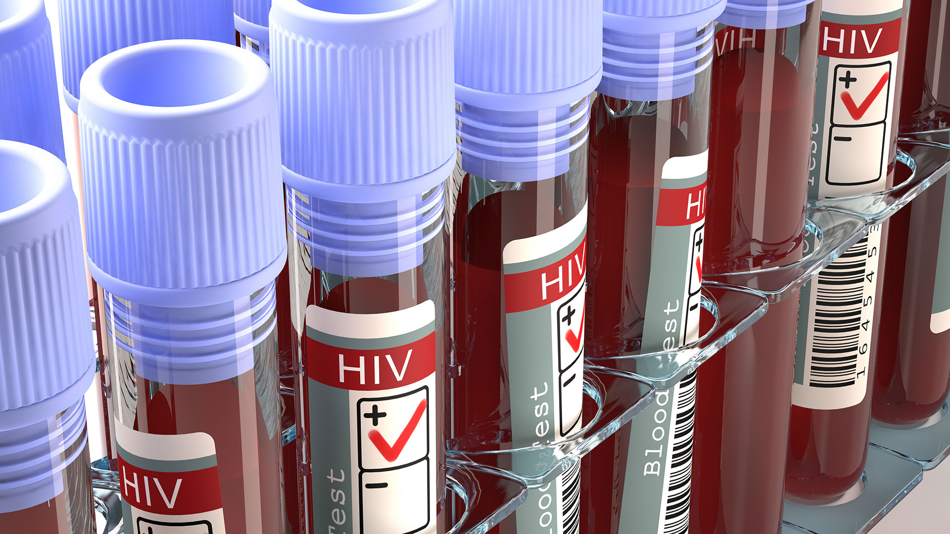 zakazenie-wirusem-hiv